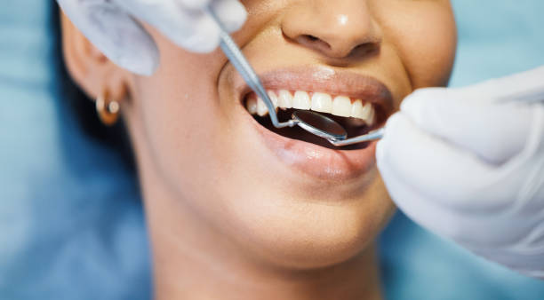 Best Emergency Tooth Extraction in Ellington, MO