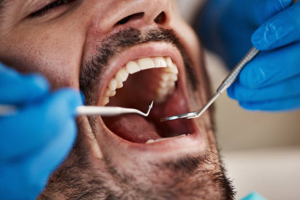 Best Pediatric Emergency Dentist in Ellington, MO